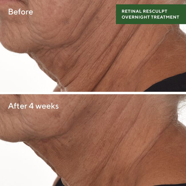 Retinal ReSculpt Overnight Treatment