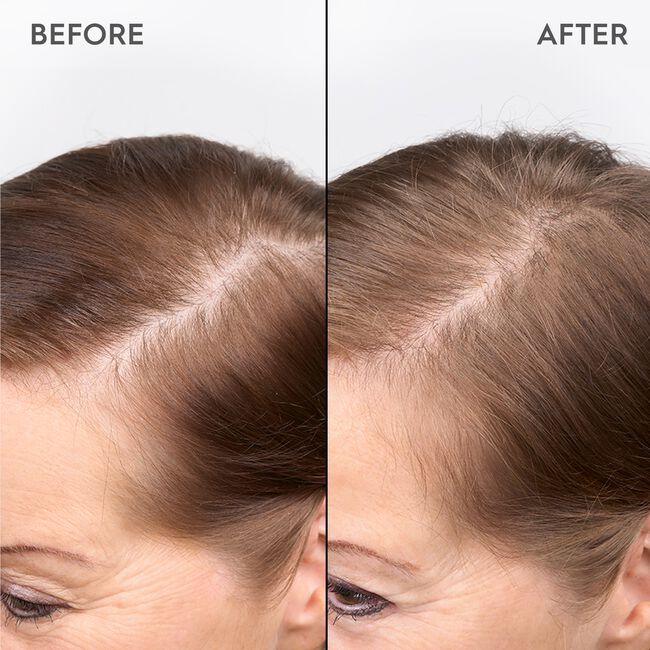 Redensifying Scalp Serum