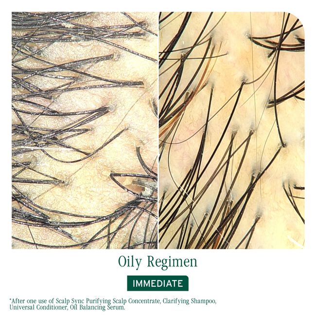 Scalp Sync Oil Balancing Serum for Oily Scalp