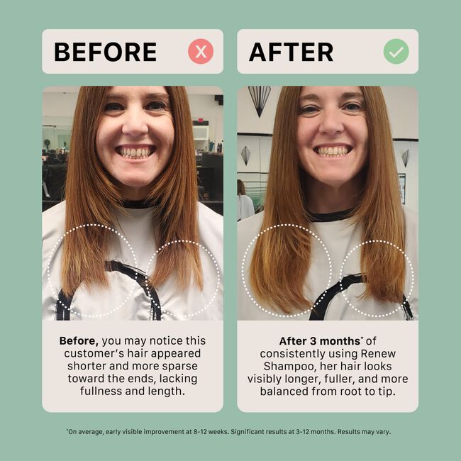 Renew Healing Shampoo Treatment