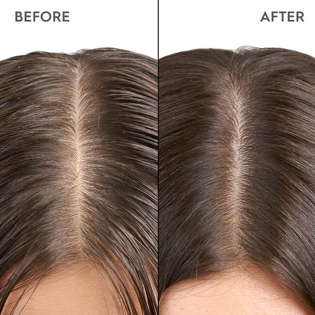 Exfoliating Scalp & Hair Treatment