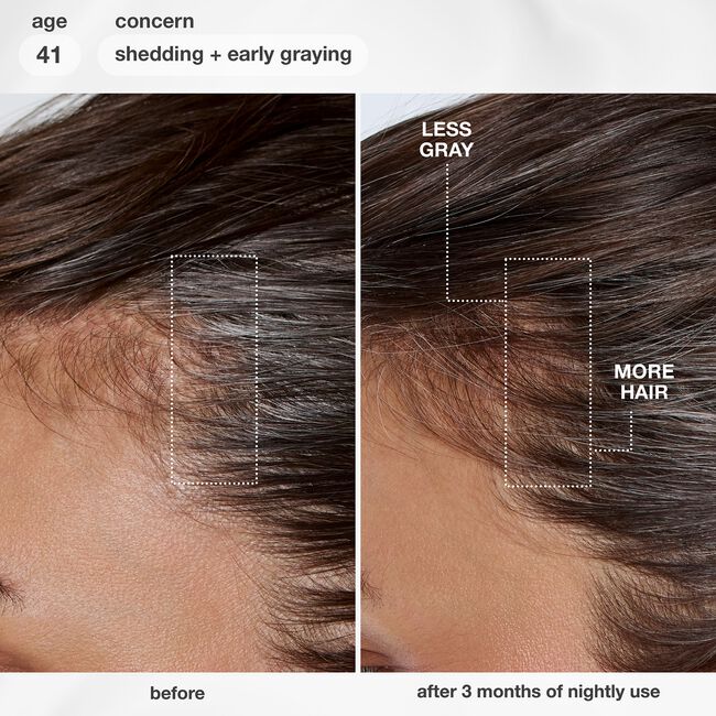 FutureIQ Biomimetic Hair Longevity Serum