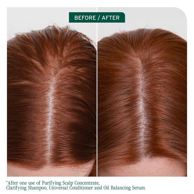 Scalp Sync Clarifying Shampoo for Oily Scalp