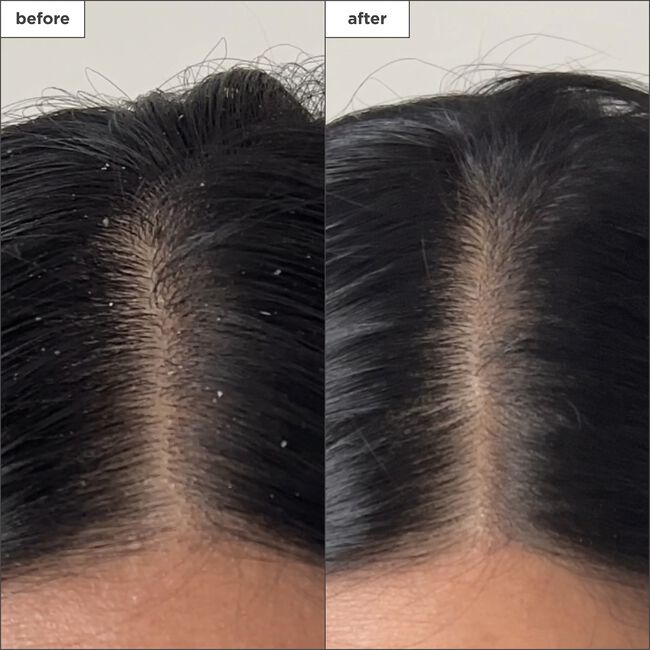 Scalp Revival Charcoal & Tea Tree Buildup Detox Spray