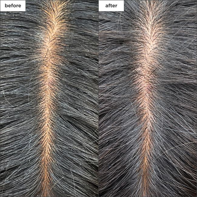 Scalp Revival Charcoal & Tea Tree Cooling Hydration Scalp Mask