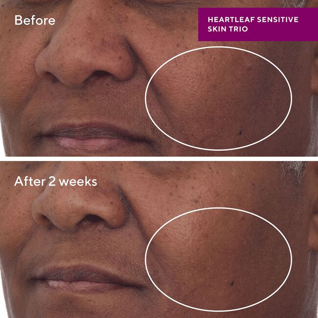Heartleaf Calming Cream