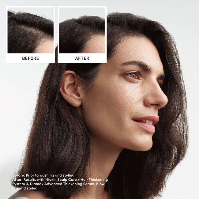 System 3 Scalp Treatment