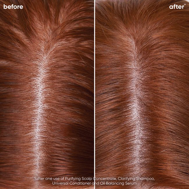 Scalp Sync Oil Balancing Serum