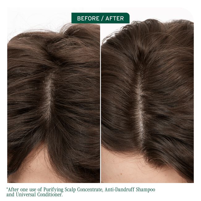 Scalp Sync Pyrithione Zinc Antidandruff Shampoo