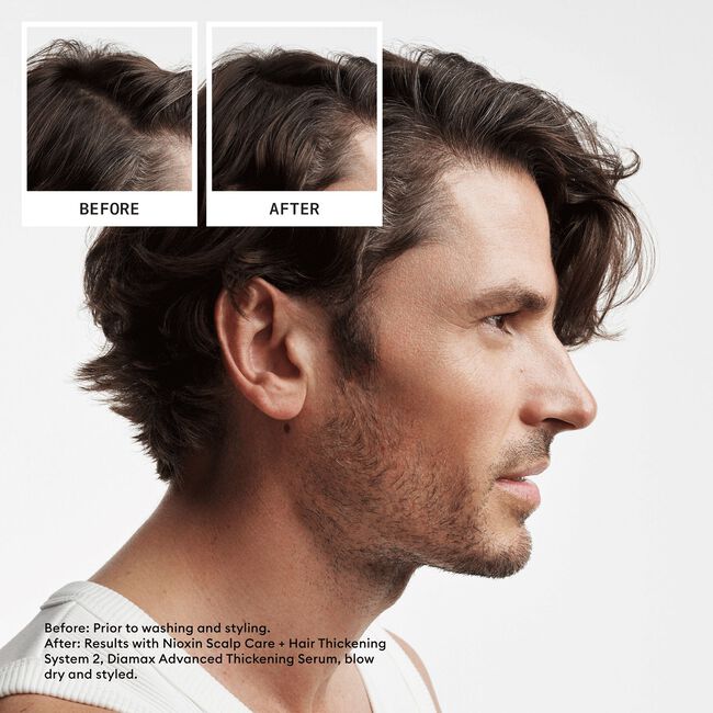 System 2 Scalp Treatment